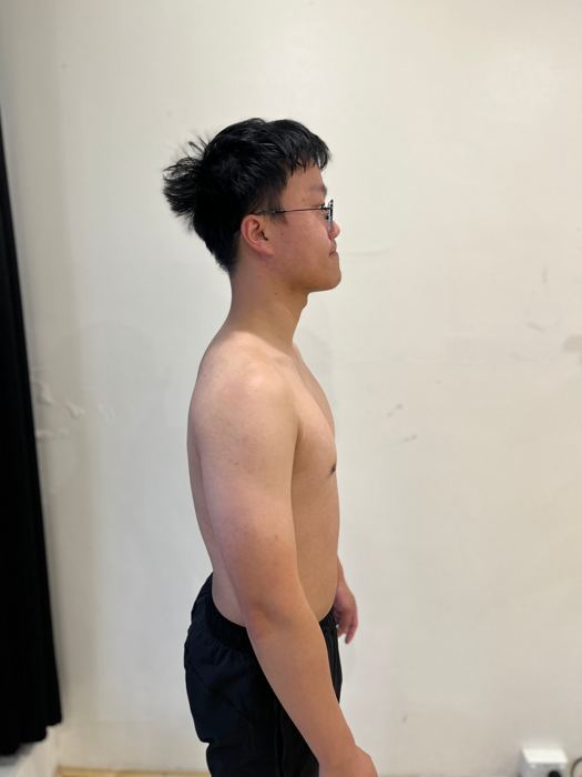 Client progress photo